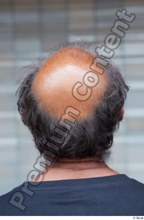 Street  637 bald hair head 0002.jpg